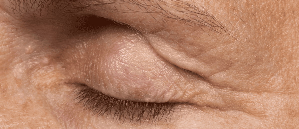 SOLTA_THERMAGE_HCP_BROCHURE_2025_05_12-39