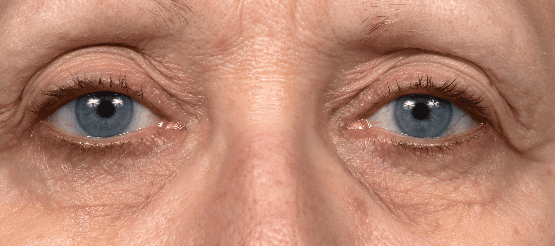 SOLTA_THERMAGE_HCP_BROCHURE_2025_05_12-42